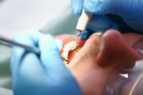 Best Mobile Emergency Dentist in El Reno, OK