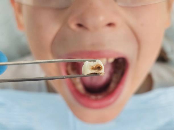 Best Urgent Dental Care for Toothache in El Reno, OK